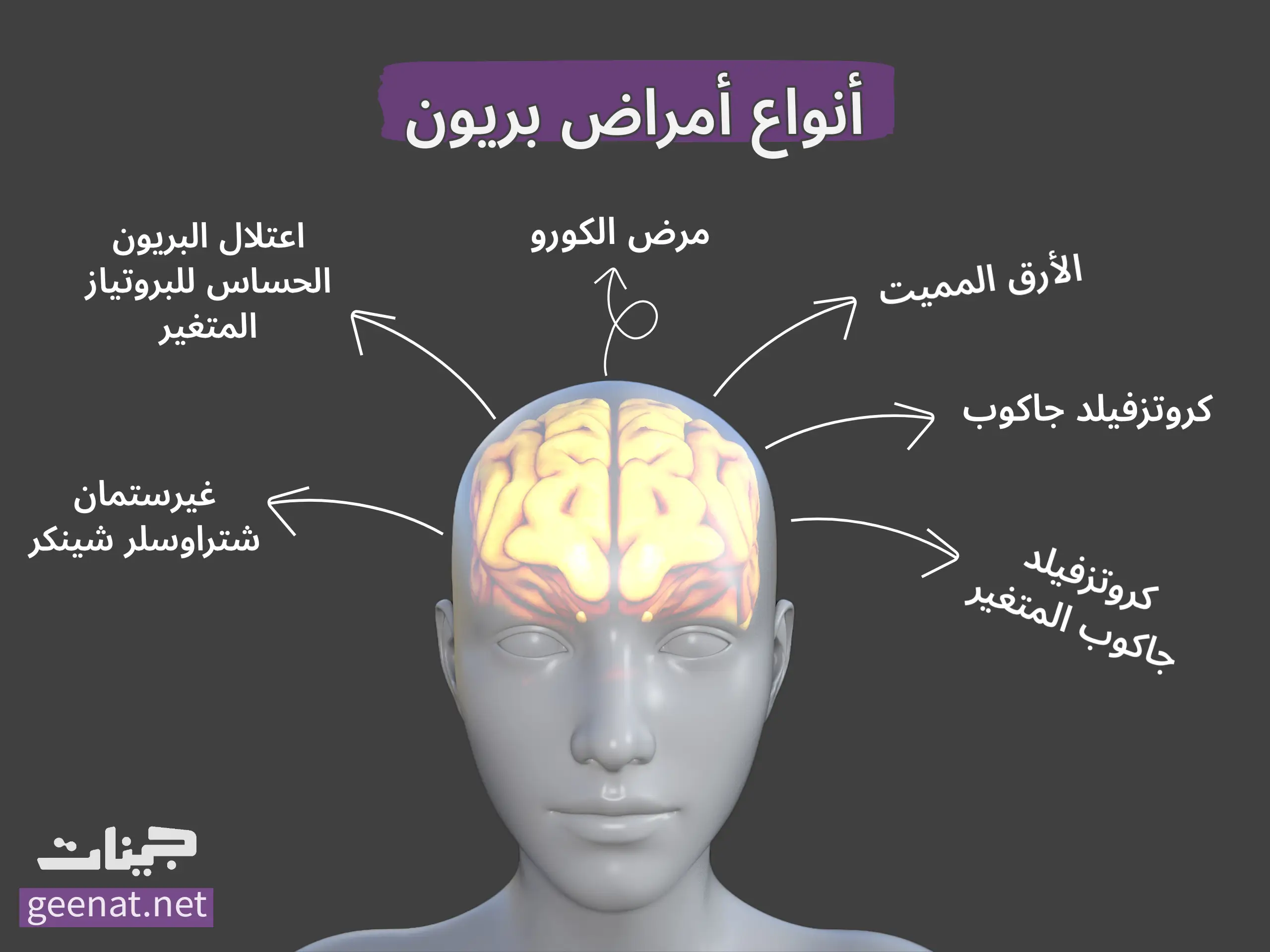 أنواع أمراض بريون - انفوجراف