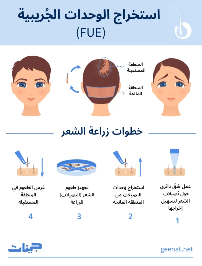 انفوجراف يستعرض خطوات إجراء عملية زراعة الشعر من نوع (FUE)